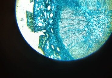 25/26 PT Bakterie a viry